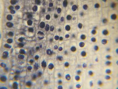 Priprema za nastavu-mitoza