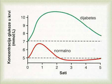 Scenarij poučavanja-Kako izravnati šećer?