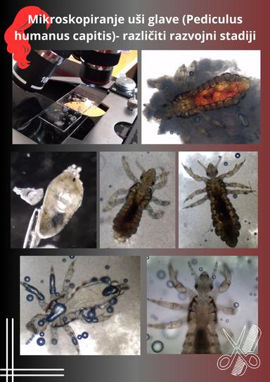 Istraživački projekt- POVEZANOST ZARAZE UŠIMA GLAVE S NEKIM OBILJEŽJIMA LJUDSKE KOSE I SPOLOM OSOBA    